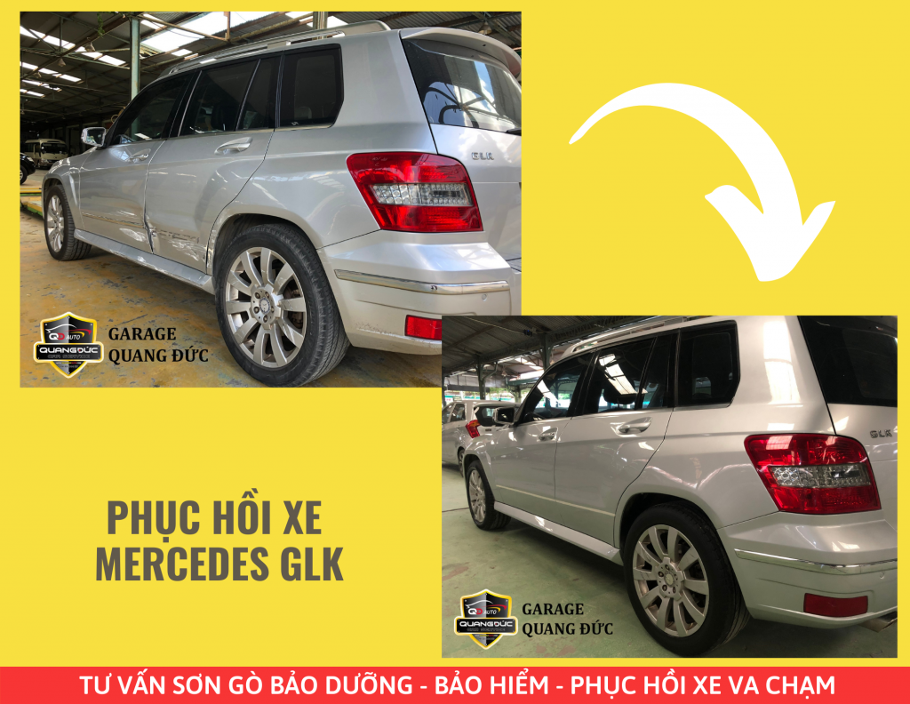 PHỤC HỒI XE   MERCEDES GLK .png