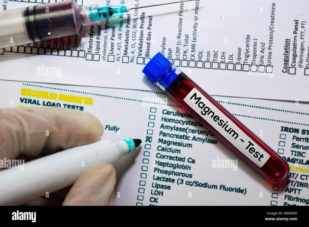 magnesium-test-with-blood-sample-top-view-isolated-on-office-desk-healthcaremedical-concept-WG...jpg