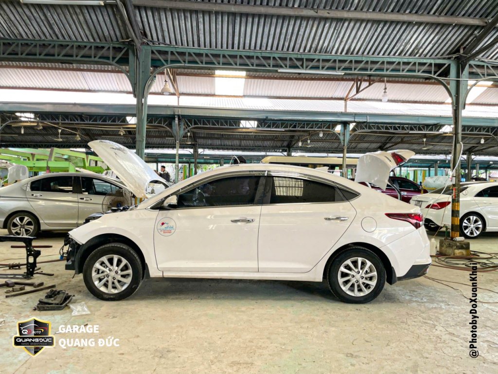 HYUNDAI ACCENT - TAI NẠN VỠ ĐÈN, BIẾN DẠNG XƯƠNG ĐẦU XE quangducauto kahiphuchoi (20).jpg