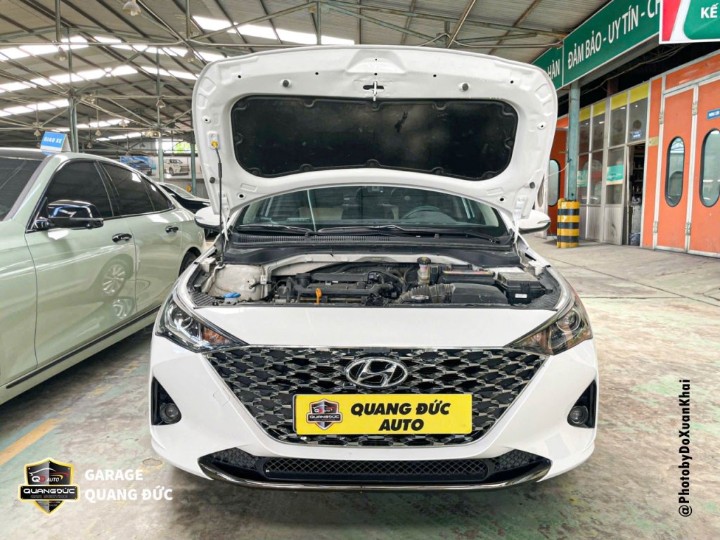 HYUNDAI ACCENT - TAI NẠN VỠ ĐÈN, BIẾN DẠNG XƯƠNG ĐẦU XE quangducauto kahiphuchoi (3).jpg