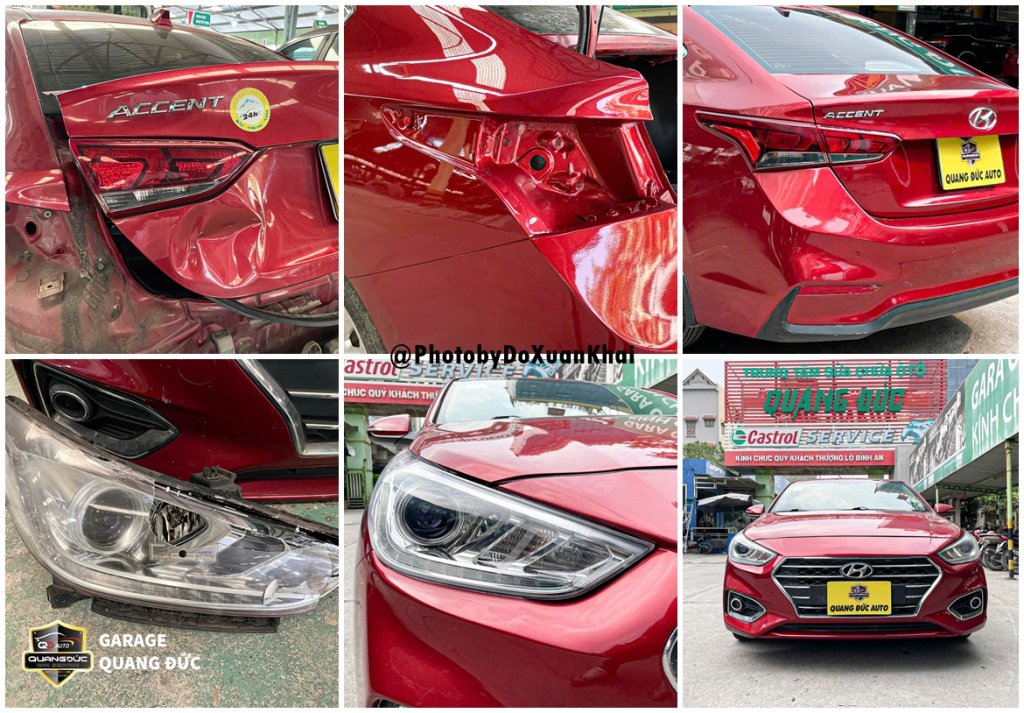 HYUNDAI ACCENT - VA CHẠM ĐẦU ĐUÔI quangducauto khaichoixe (1).jpg