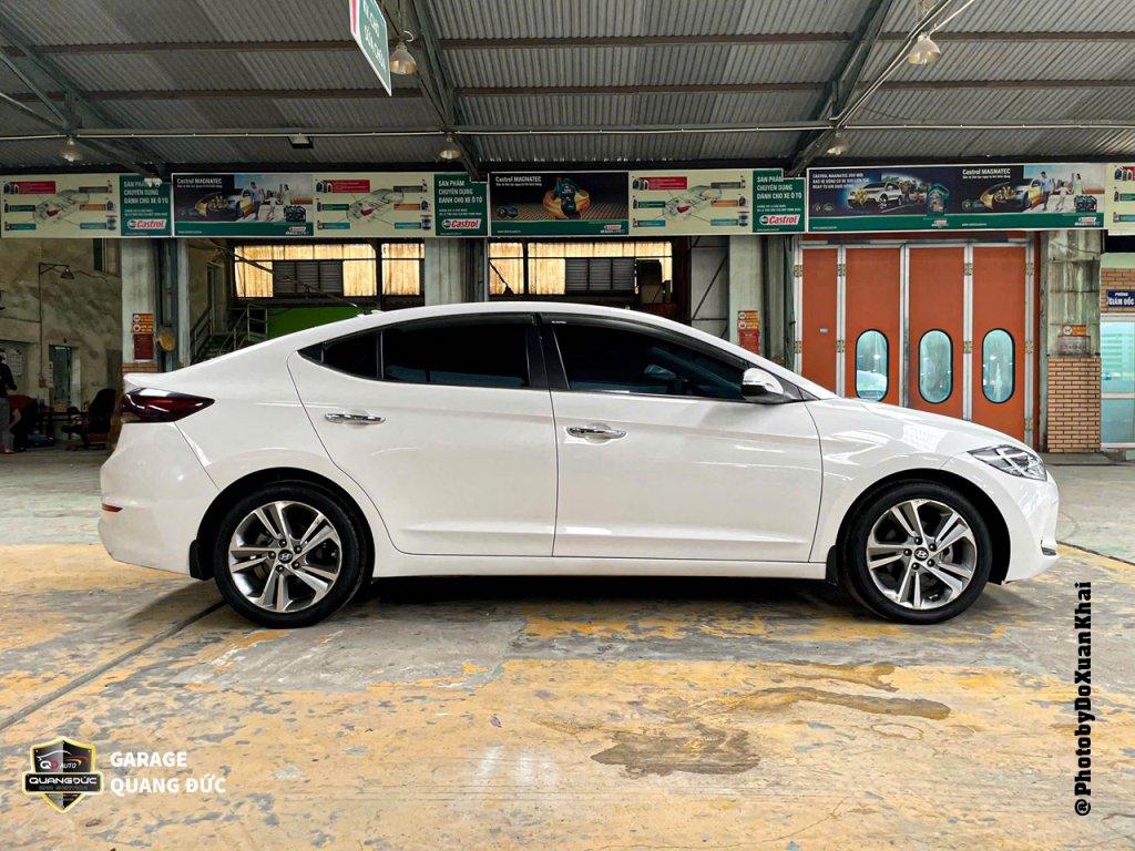 HYUNDAI ELANTRA 2017 TRĂNG - PHỤC HỒI PHẦN TRƯỚC PHỤ quangduc khaiphuchoi (41).jpg