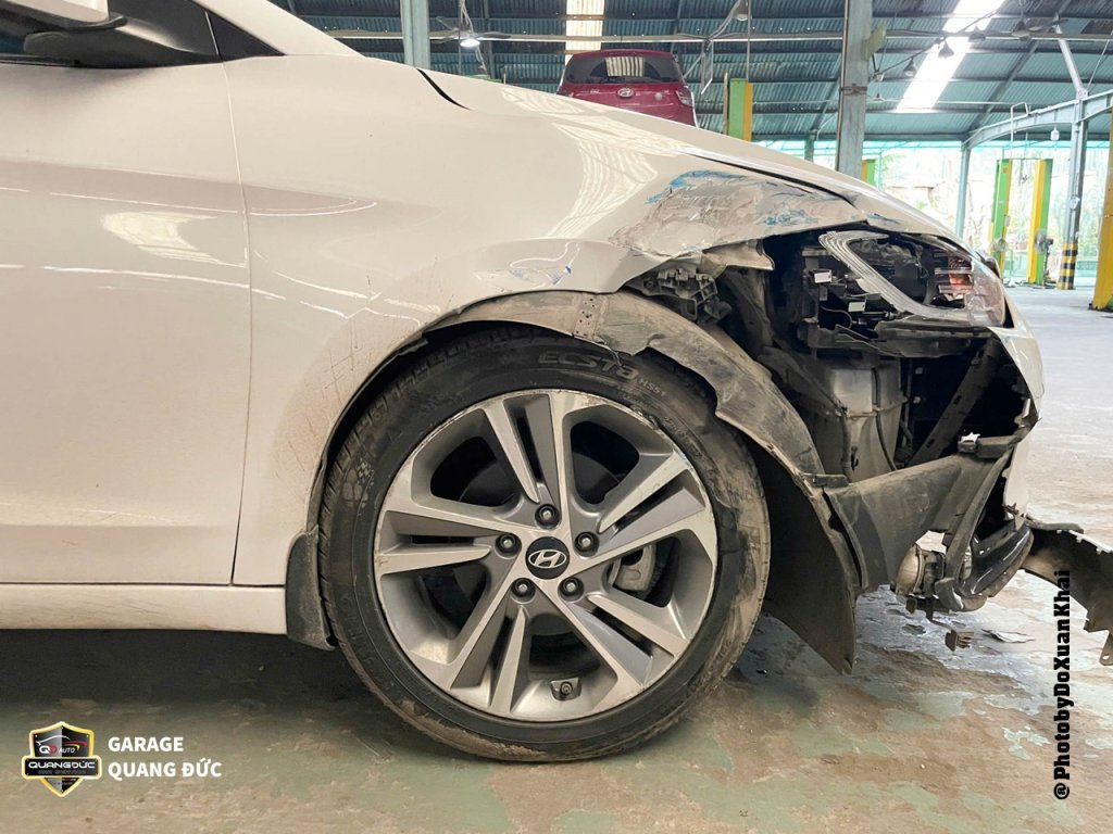 HYUNDAI ELANTRA 2017 TRĂNG - PHỤC HỒI PHẦN TRƯỚC PHỤ quangduc khaiphuchoi (4).jpg