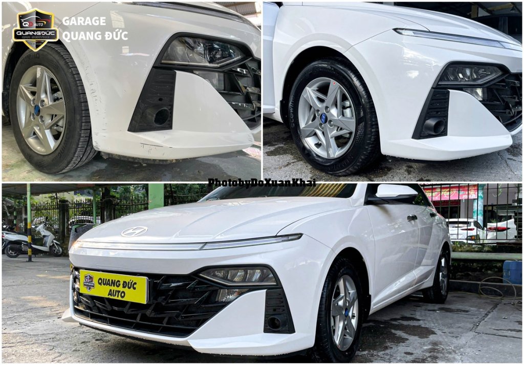 HYUNDAI ACCENT - XƯỚC CẢN TRƯỚC quangduc khaiphuchoi (1).jpg