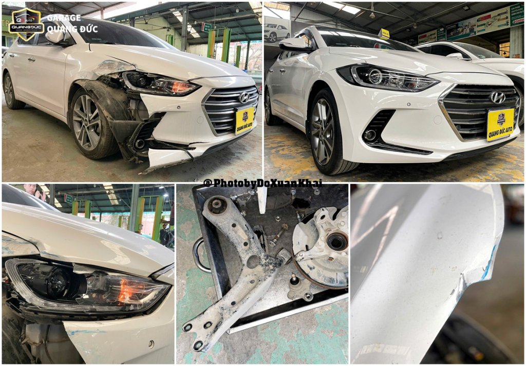 HYUNDAI ELANTRA 2017 TRĂNG - PHỤC HỒI PHẦN TRƯỚC PHỤ quangduc khaiphuchoi (1).jpg
