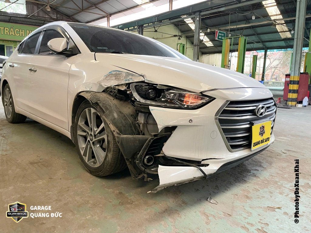 HYUNDAI ELANTRA 2017 TRĂNG - PHỤC HỒI PHẦN TRƯỚC PHỤ quangduc khaiphuchoi (3).jpg