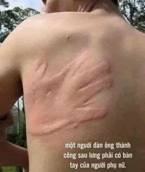 Dau tay nguoi phu nu.jpg