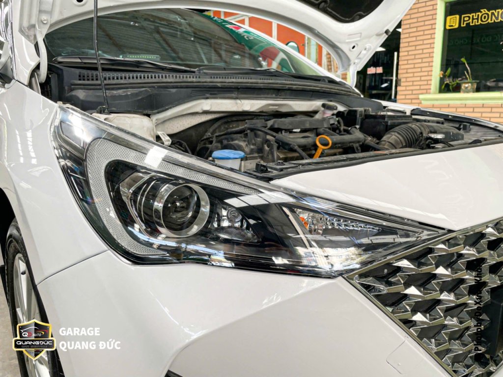 HYUNDAI ACCENT - TAI NẠN VỠ ĐÈN, BIẾN DẠNG XƯƠNG ĐẦU XE quangducauto kahiphuchoi (5).jpg