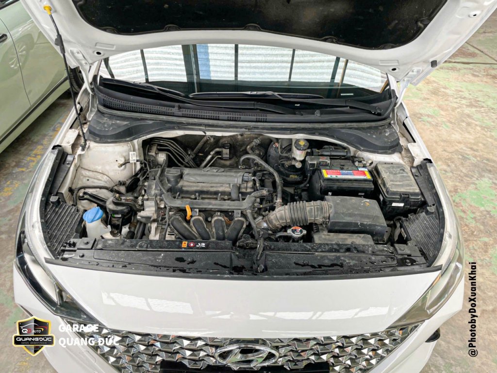 HYUNDAI ACCENT - TAI NẠN VỠ ĐÈN, BIẾN DẠNG XƯƠNG ĐẦU XE quangducauto kahiphuchoi (24).jpg