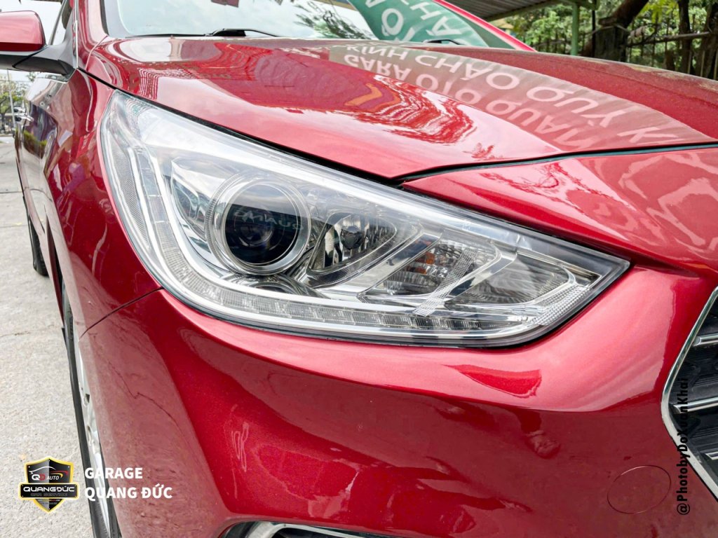 HYUNDAI ACCENT - VA CHẠM ĐẦU ĐUÔI quangducauto khaichoixe (15).jpg