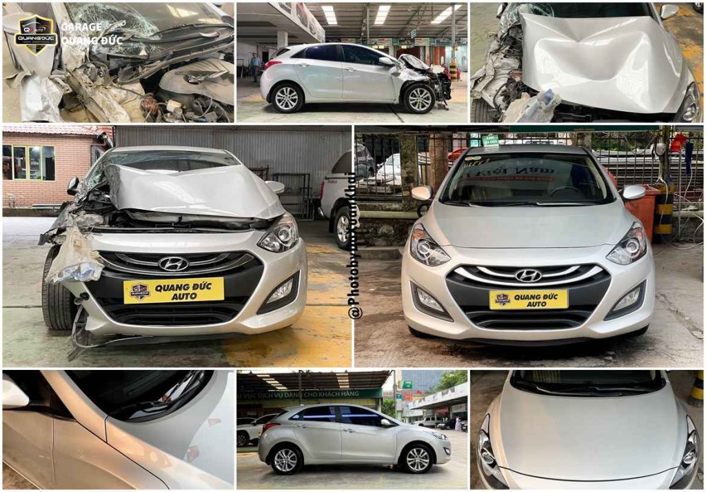 HYUNDAI I30 BẠC - TAI NẠN ĐẦU XE BÊN PHỤ (1).jpg
