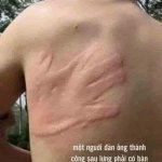 Dau tay nguoi phu nu.jpg